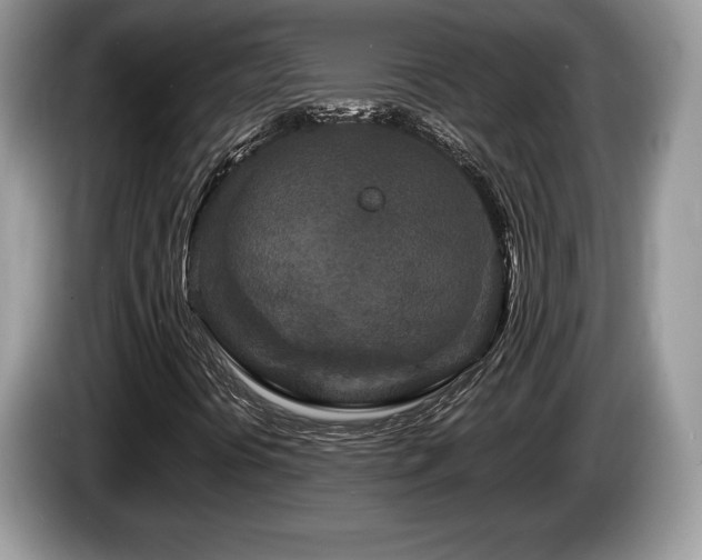 X0000087611394200704271332