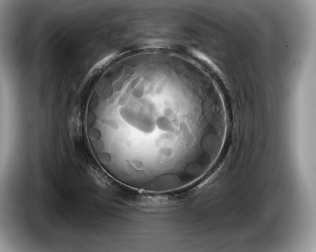 X0000087611403200704271332