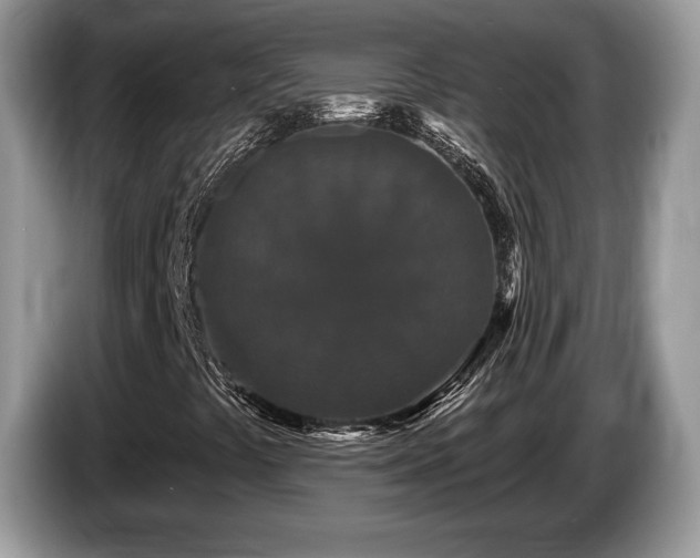 X0000087611441200704271332