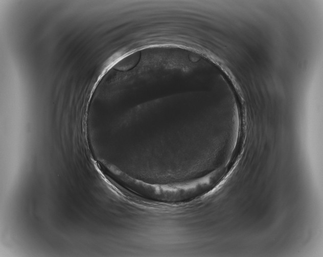 X0000087611529200704271332