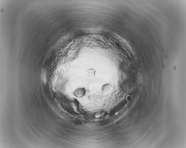 X0000087610069200705120004