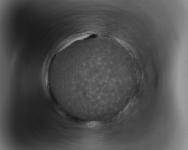 X0000087610050200705181302