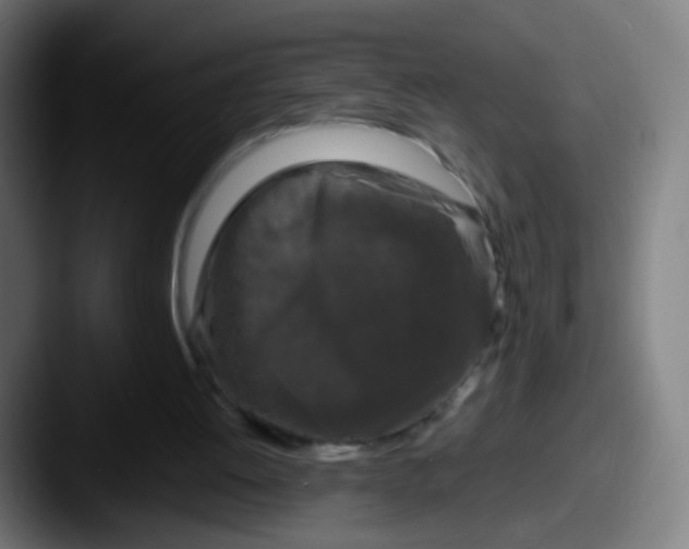 X0000087610052200705181302