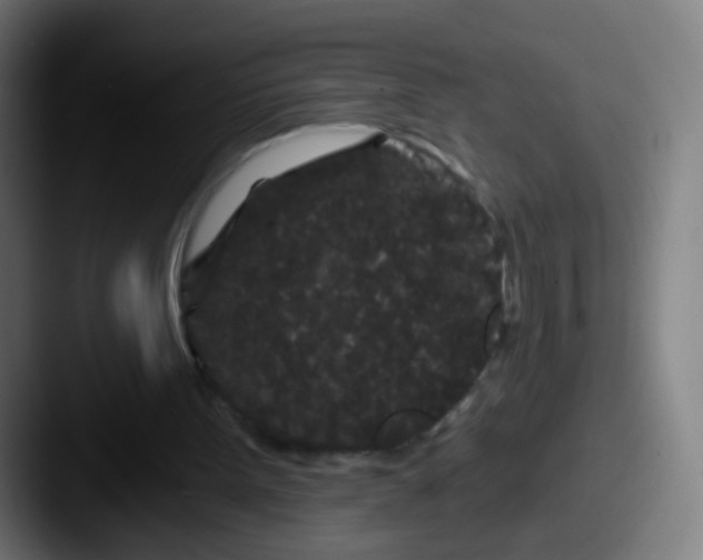 X0000087610099200705181302