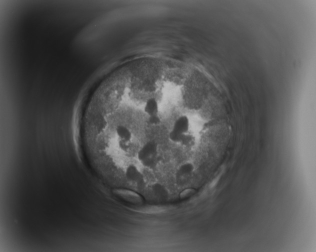 X0000087610149200705181301