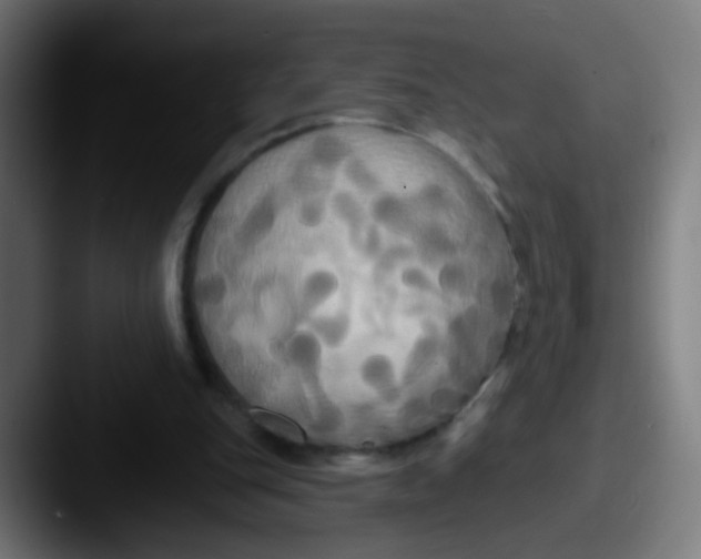 X0000087610151200705181301