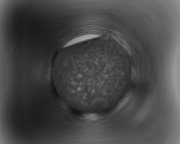 X0000087610189200705181302