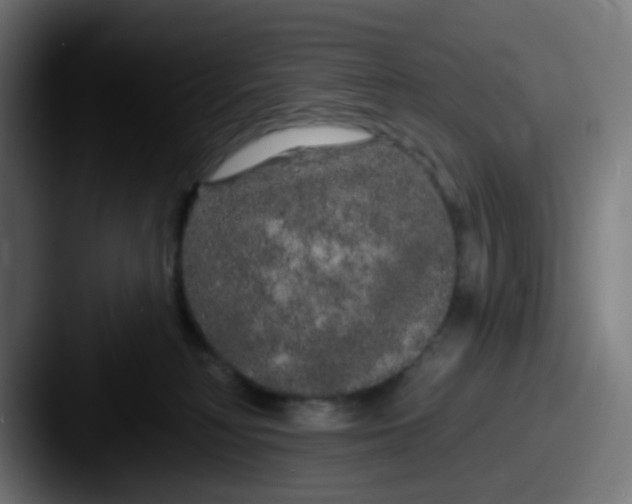 X0000087610230200705181301