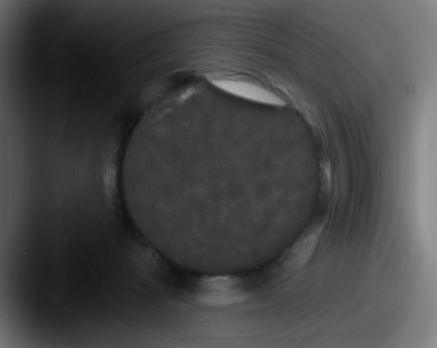 X0000087610269200705181300