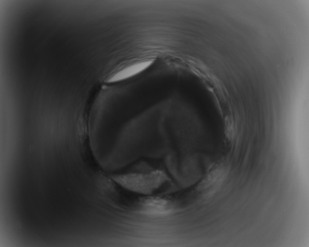 X0000087610471200705181258