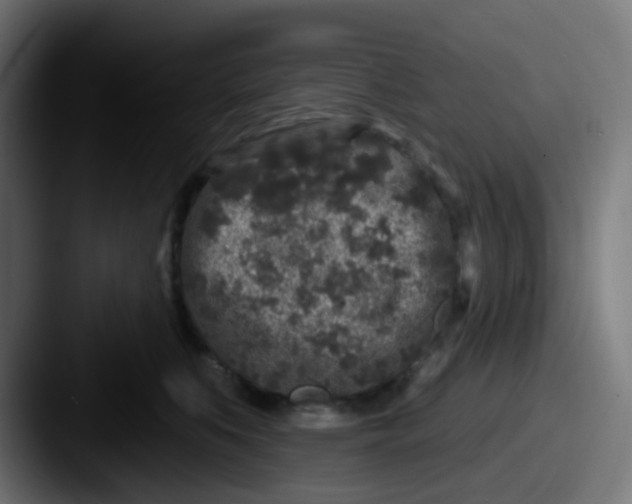 X0000087610519200705181257