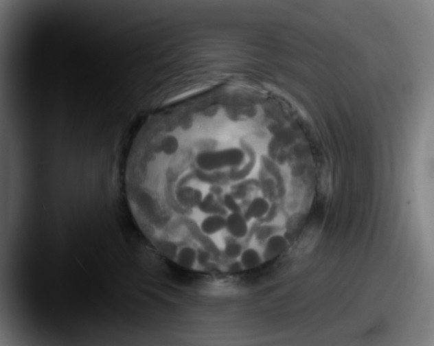 X0000087610569200705181257