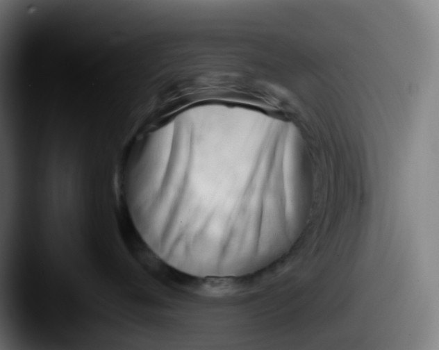 X0000087610720200705181255