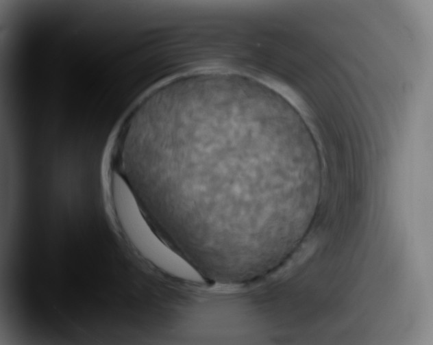 X0000087611008200705181252