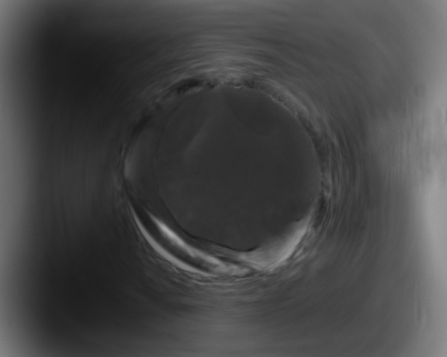X0000087611010200705181251