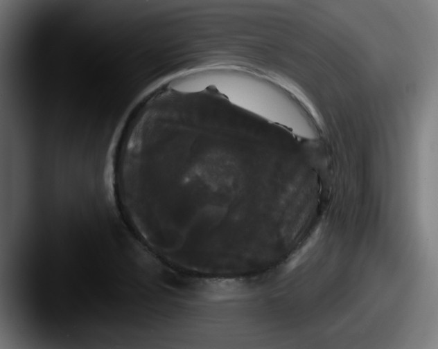X0000087611024200705181251