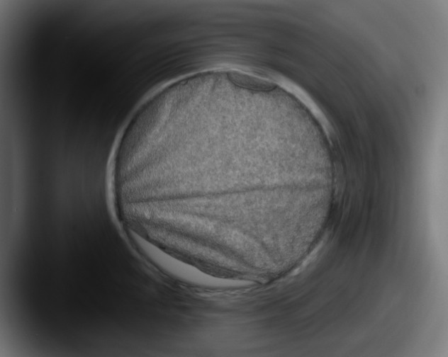 X0000087611048200705181251