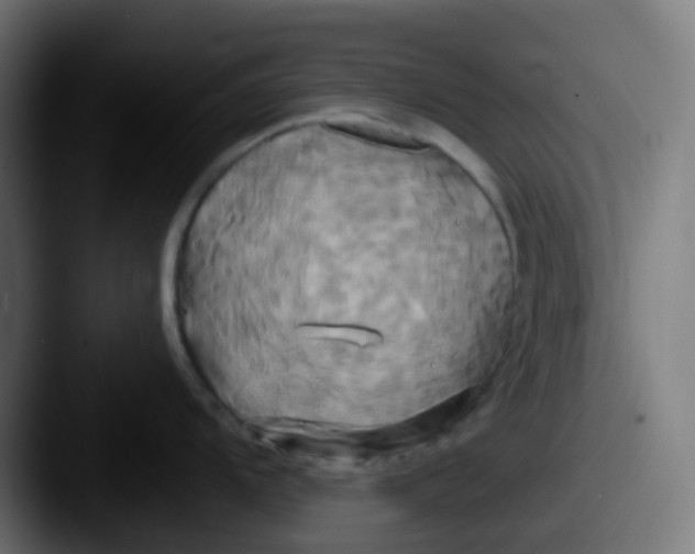 X0000087611104200705181250