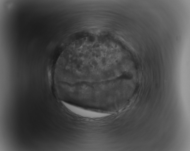 X0000087611106200705181250