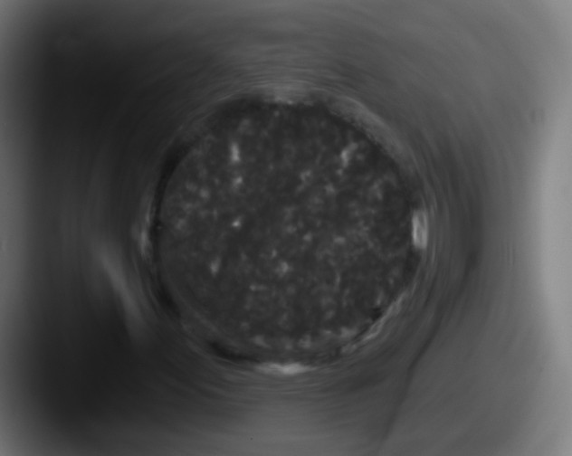 X0000087611155200705181250
