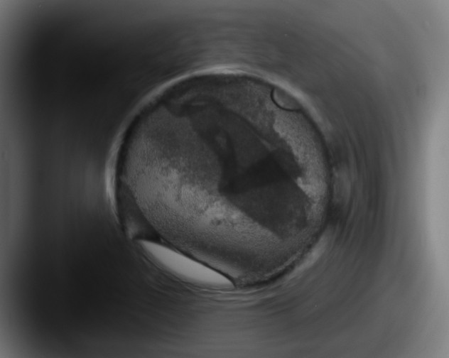 X0000087611319200705181248