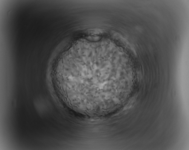 X0000087611393200705181247