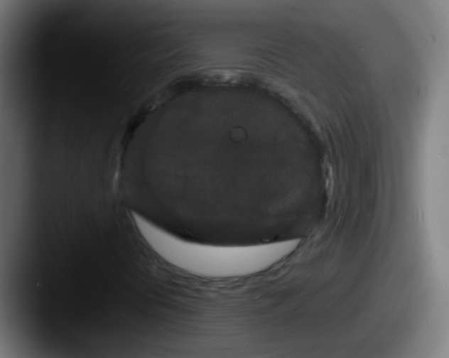 X0000087611394200705181247
