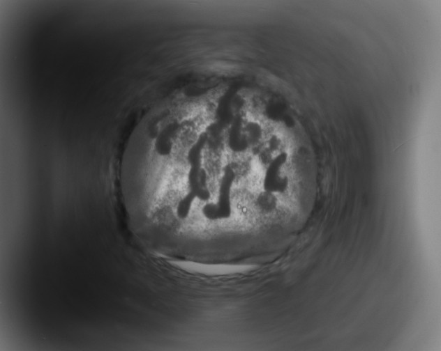 X0000087611397200705181247