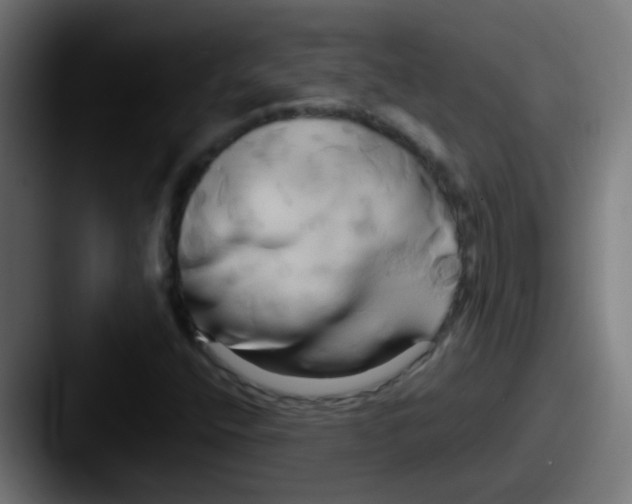 X0000087611400200705181247