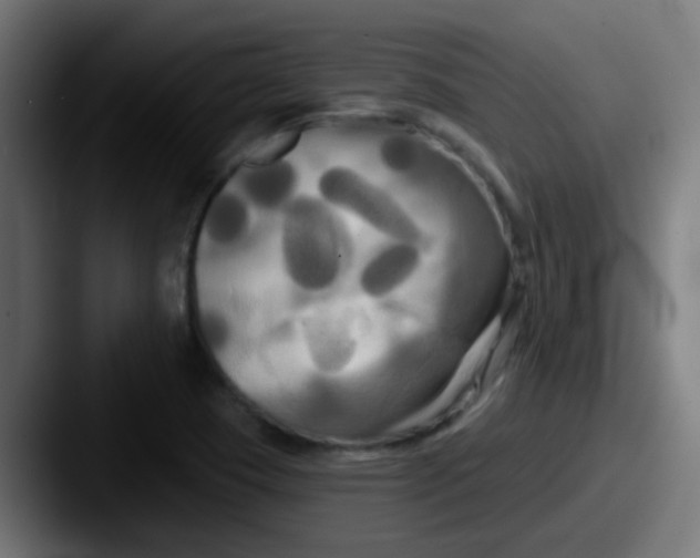 X0000087611409200705181247