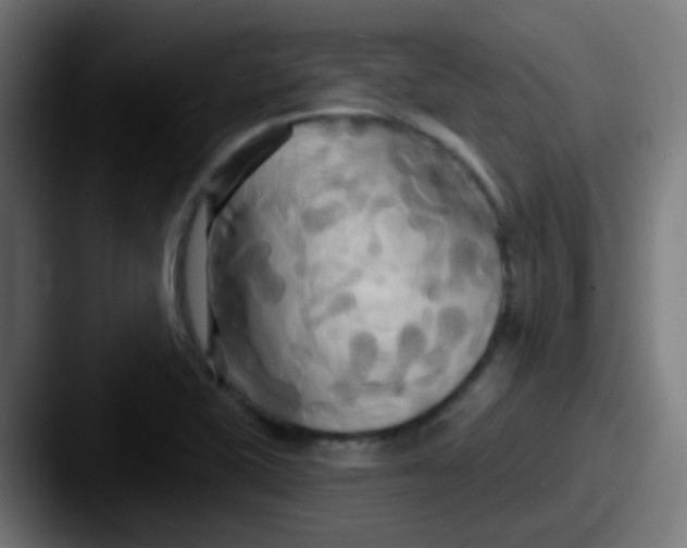 X0000087611415200705181247