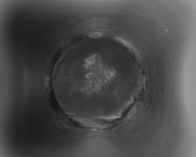 X0000087611445200705181247