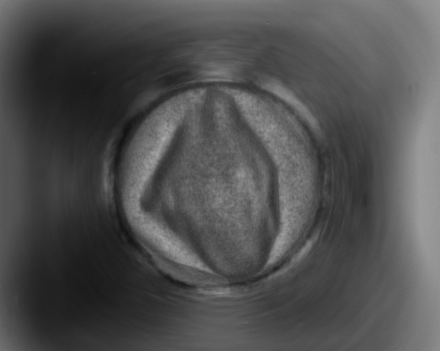 X0000087611450200705181246