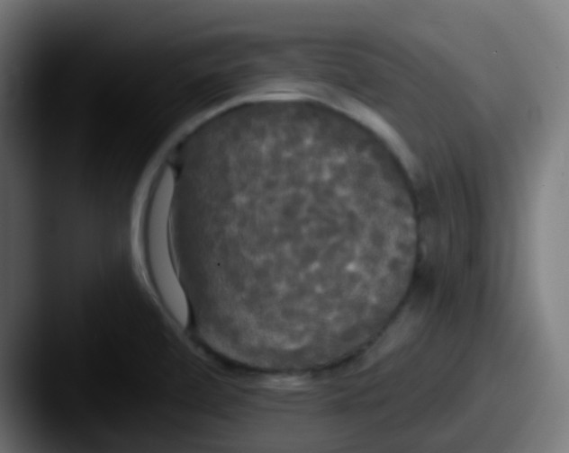 X0000087611472200705181246