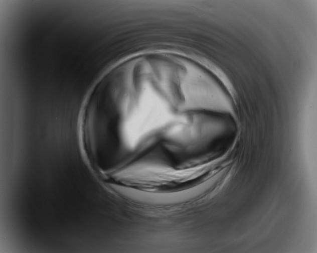 X0000087611533200705181246