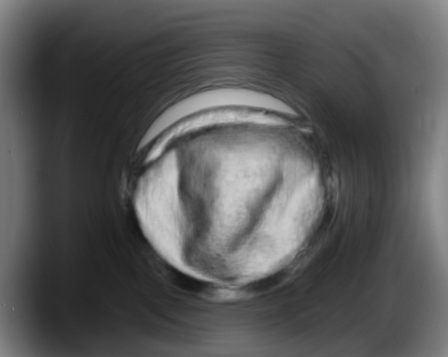 X0000087610093200705251951