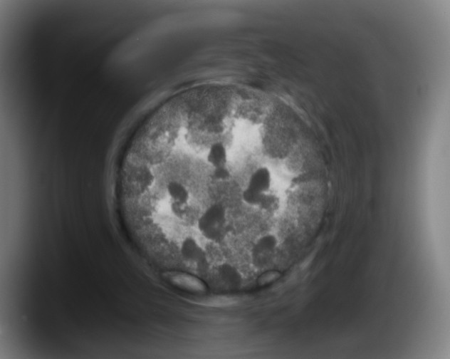 X0000087610149200705251949