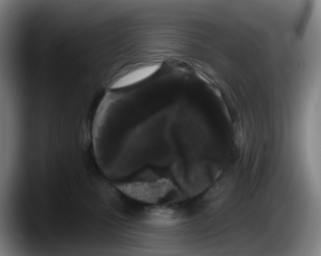 X0000087610471200705251946