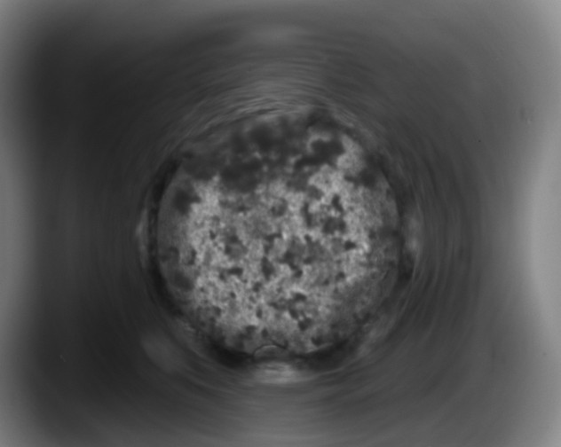 X0000087610519200705251945