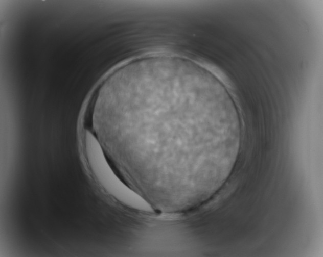 X0000087611008200705251938