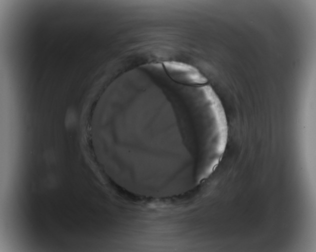 X0000087611009200705251938