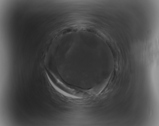 X0000087611010200705251938