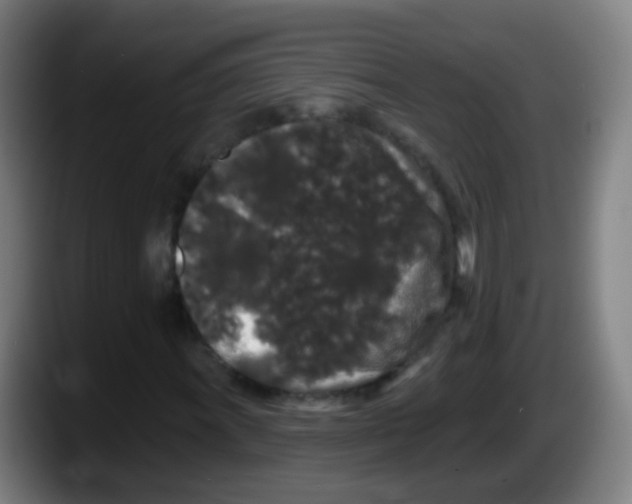 X0000087611011200705251938