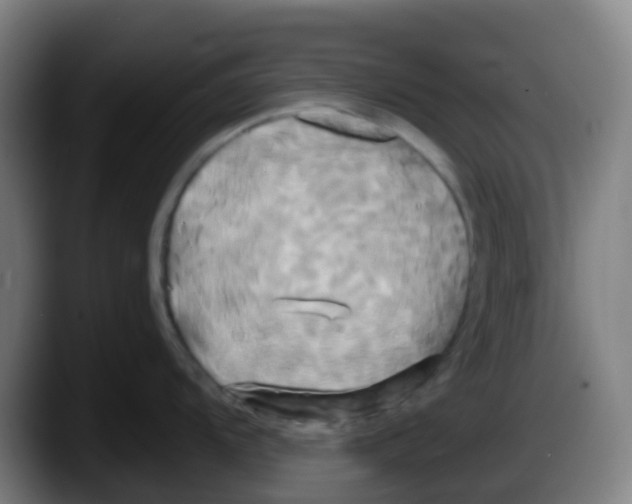 X0000087611104200705251937