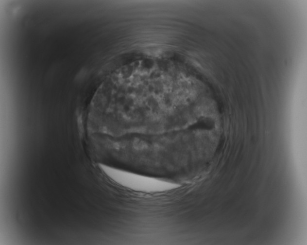 X0000087611106200705251937