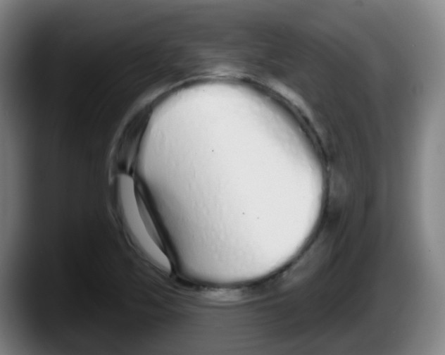 X0000087611171200705251936