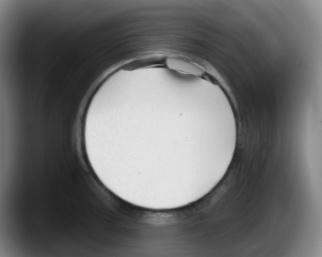 X0000087611187200705251936