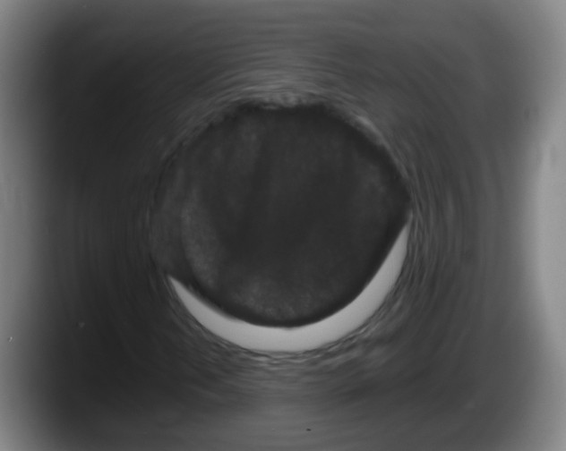 X0000087611202200705251935