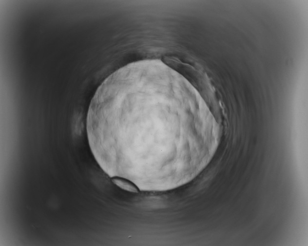 X0000087611204200705251935