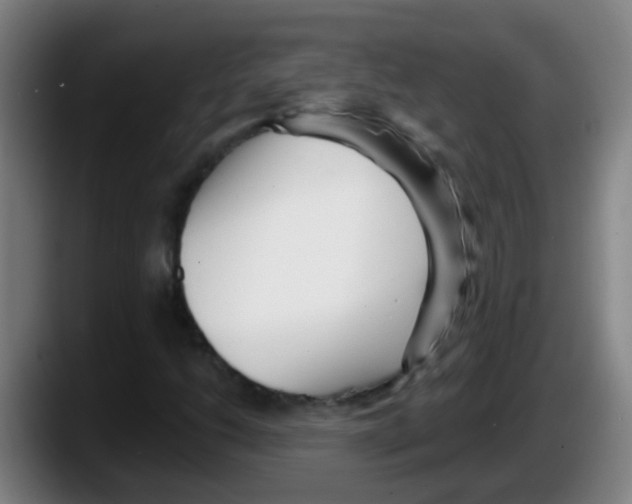 X0000087611206200705251935